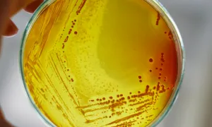 "a petri dish being held by a human"